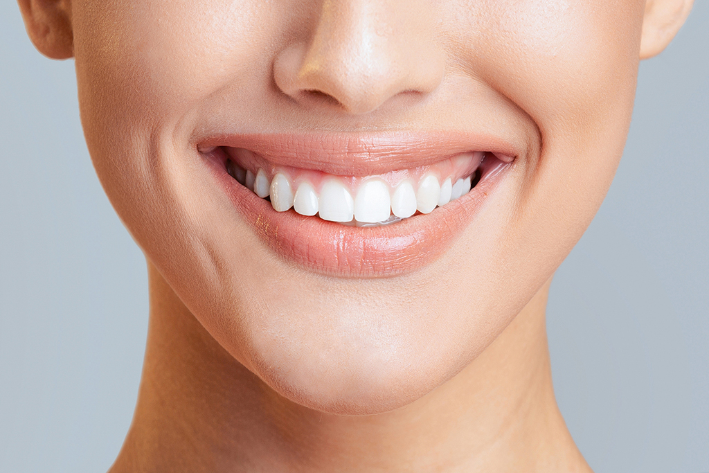 Teeth Whitening in Lathrup Village, MI | Dr. Stephen J. Krawiec, DDS, PC